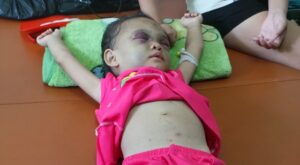 Phu Nu Today Be 4 Tuoi Bi Cha Me Hanh Hung 1 1 1